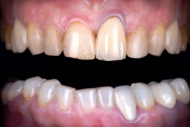Before: before dental procedure