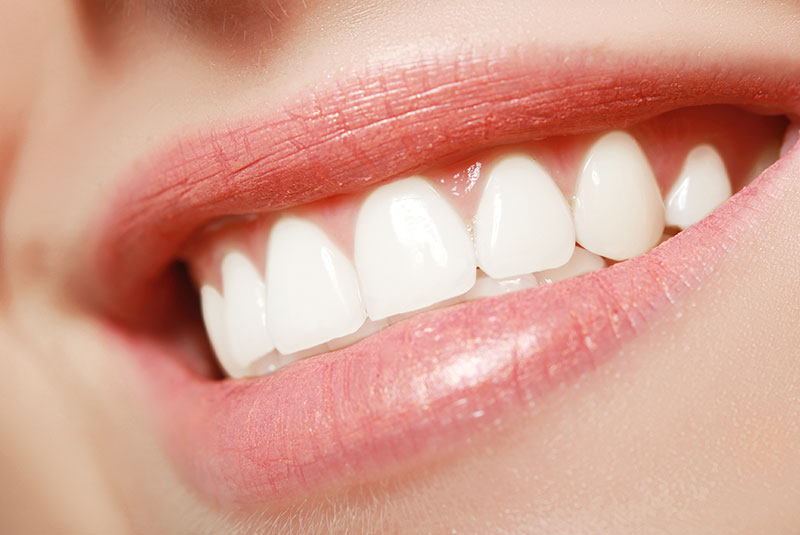 Smile