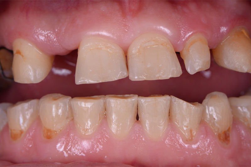 Before: before dental procedure